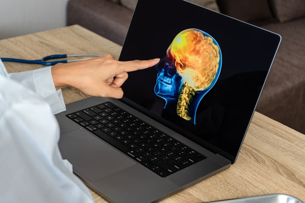 doctor reviewing MRI