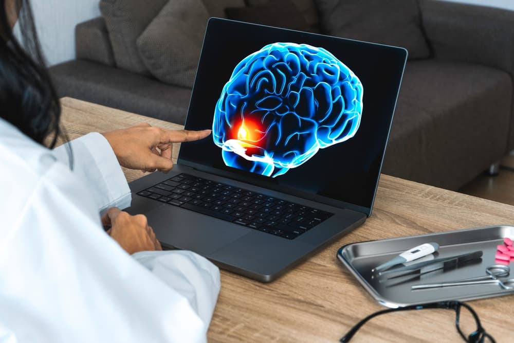 Doctor showing a x-ray of pain in the brain on a laptop